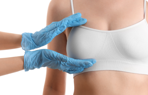Breast Reduction