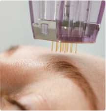 Skin regeneration via combination of light therapy and topical application of exosomes