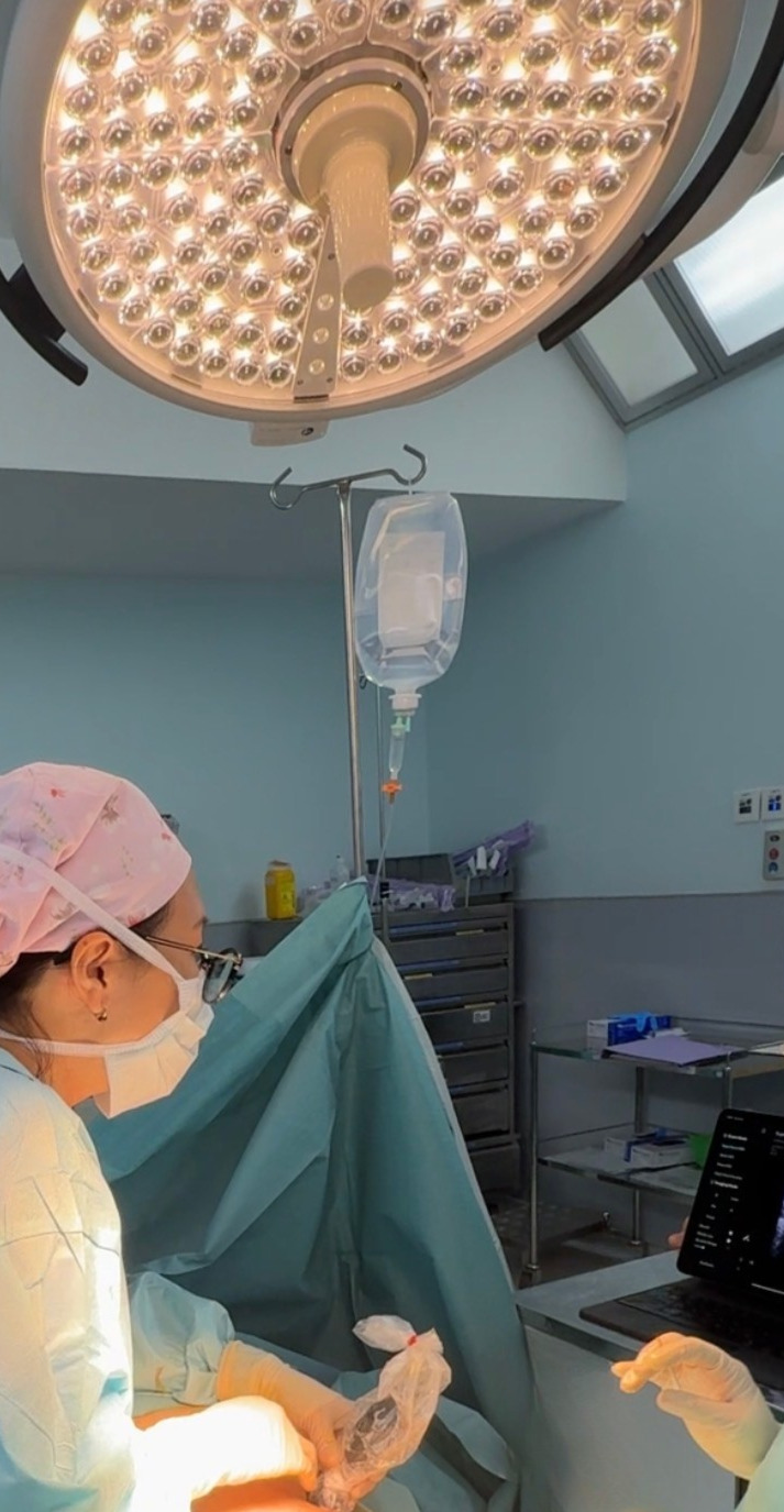 rib reshaping risks considerations waist contour Singapore.