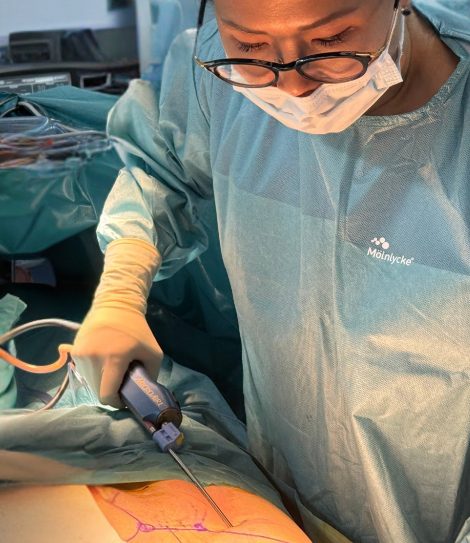 Sedot lemak (liposuction) di Singapura untuk pembentukan tubuh dan pengangkatan lemak