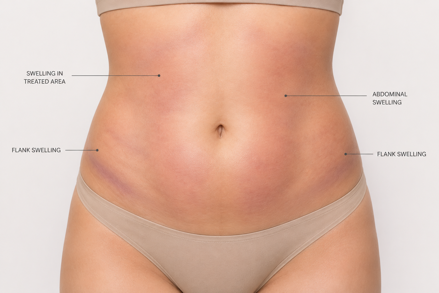 liposuction risks considerations Singapore body contouring safety consultation Dr Pearlie Tan.