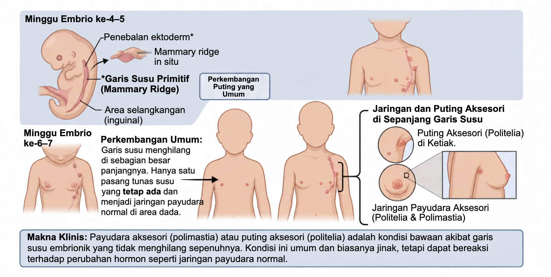 Perkembangan garis susu embrionik dan jaringan payudara aksesori (politelia dan polimastia)