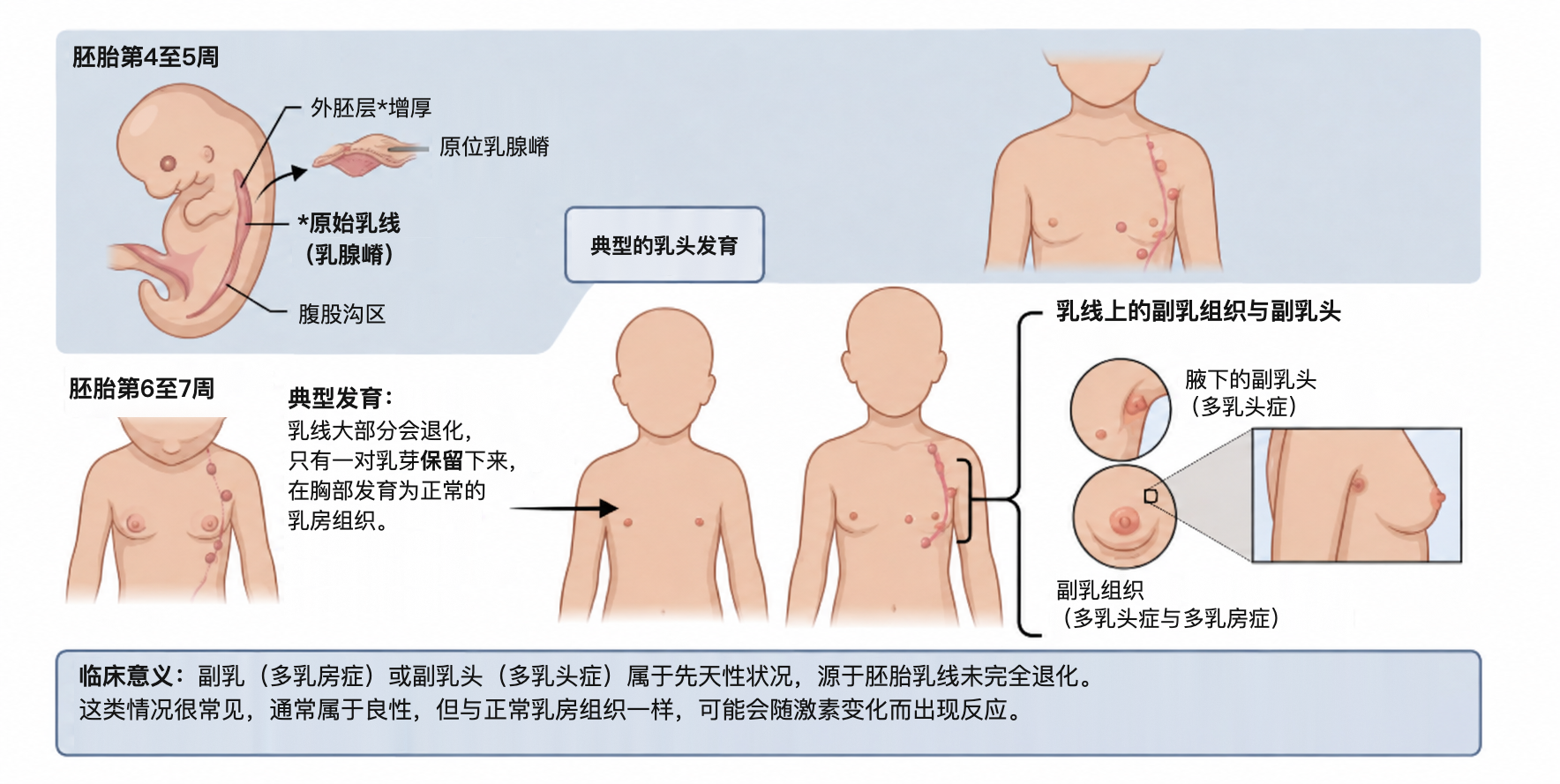 乳线的胚胎发育与副乳组织，副乳头的形成