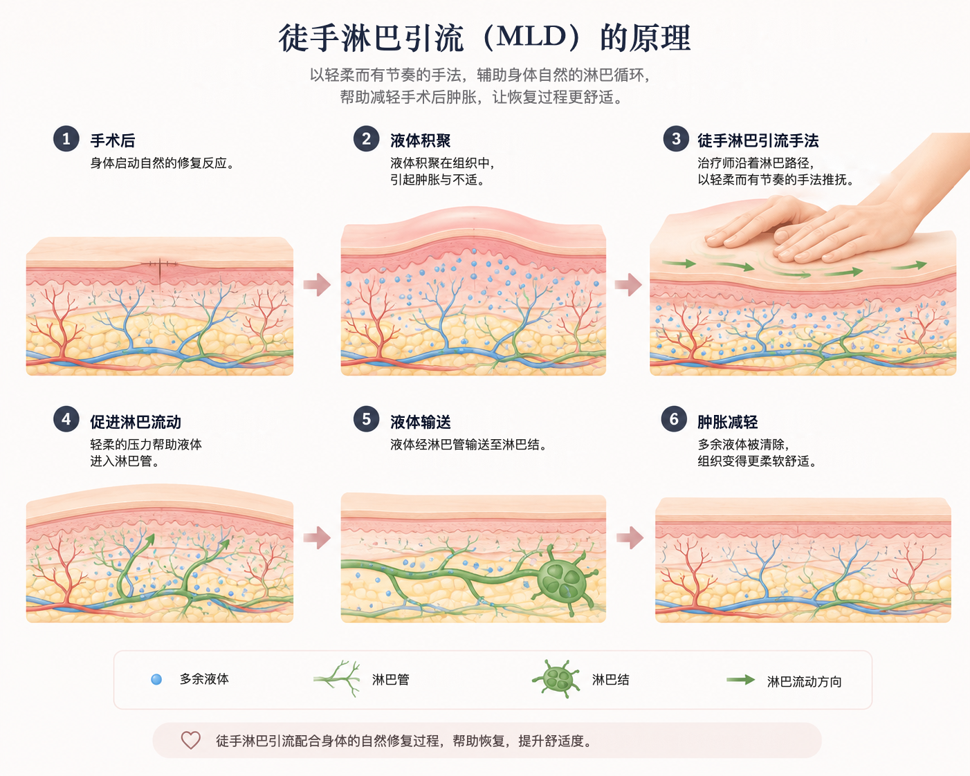 徒手淋巴引流（MLD）的原理