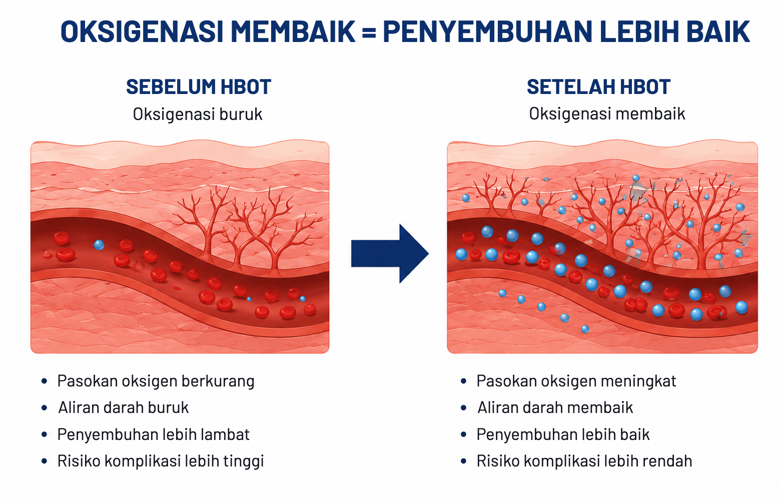 Oksigenasi membaik dengan HBOT sehingga penyembuhan lebih baik
