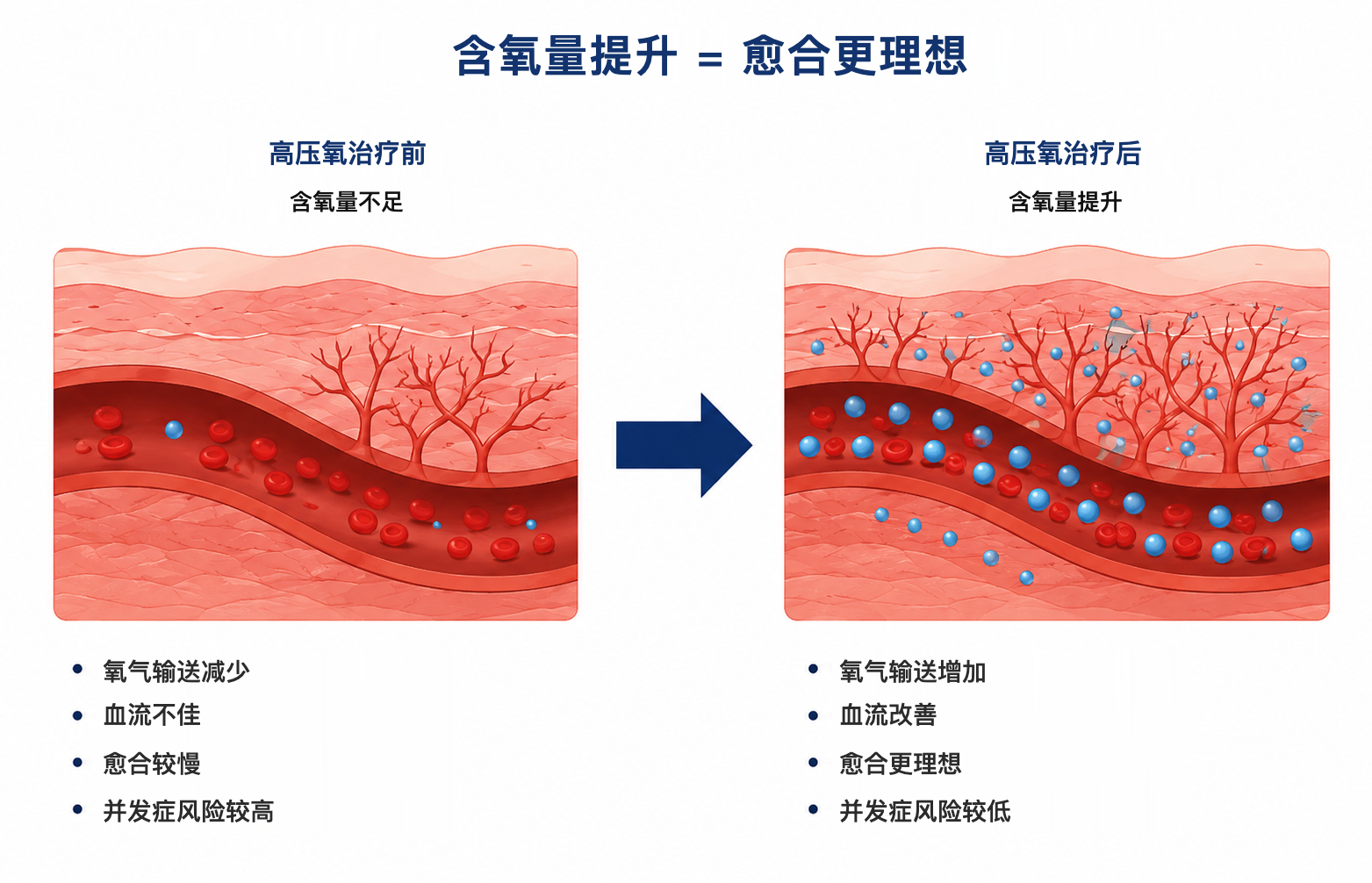 含氧量提升，愈合更理想：高压氧治疗前后对比