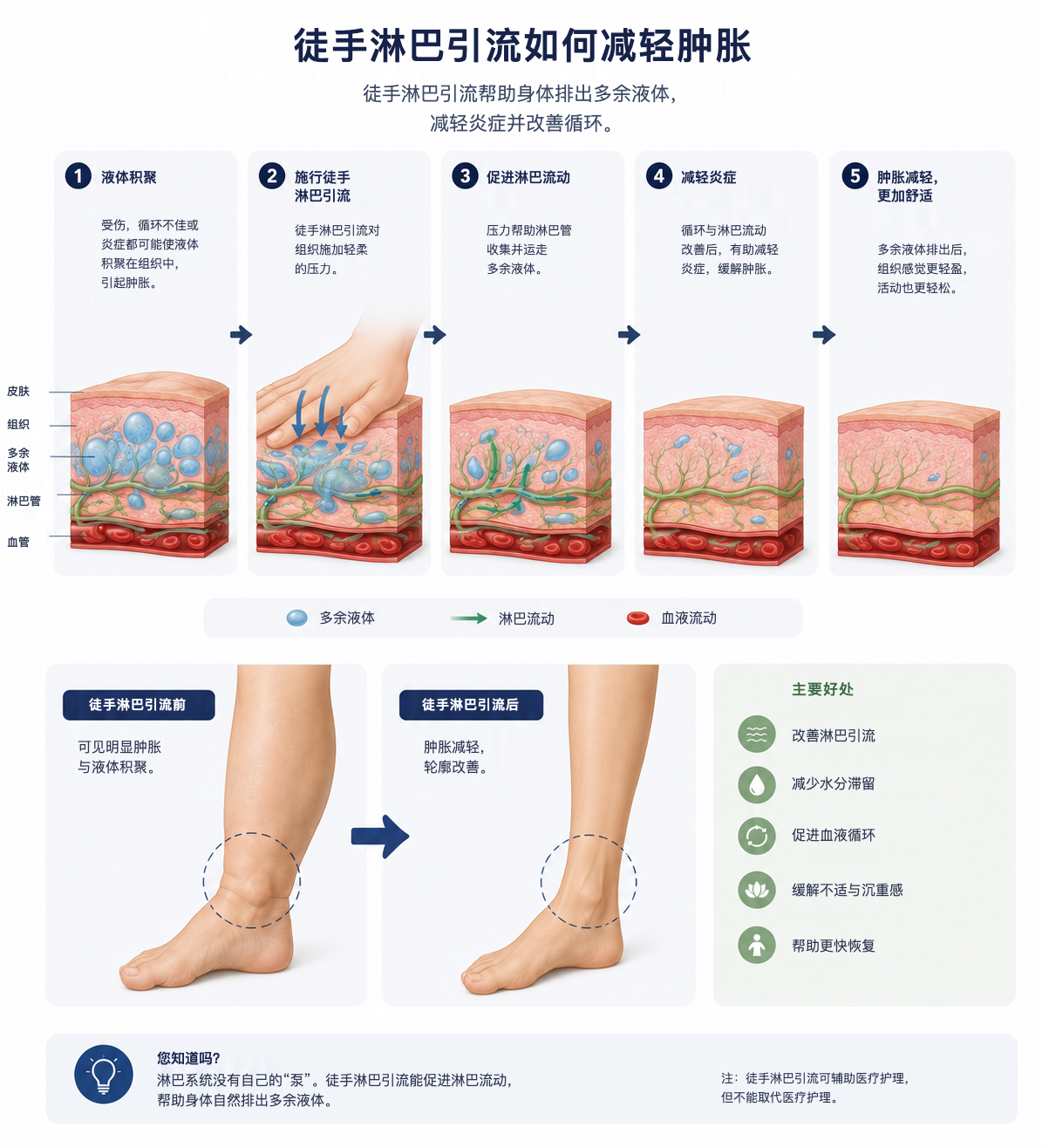 徒手淋巴引流如何减轻肿胀