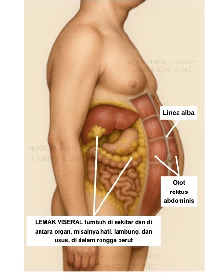 Lemak viseral di dalam rongga perut, otot rektus abdominis, dan linea alba